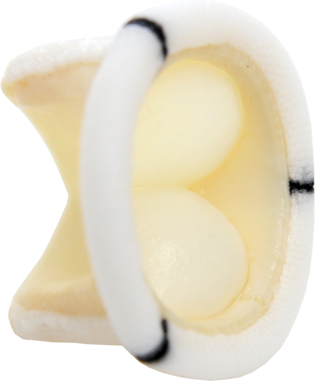 Біологічний органічний протез клапану серця з бичачого перикарду NR.33М